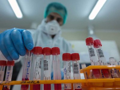 Pakistan-covid-swab-_1774ee647b5_large.jpg