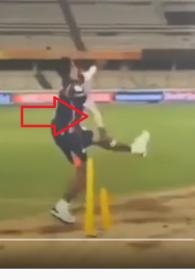 Elbow bending backwards.jpg